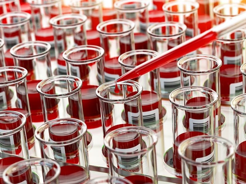open-blood-test-tubes-in-laboratory-2021-08-31-13-26-14-utc - Copy-min
